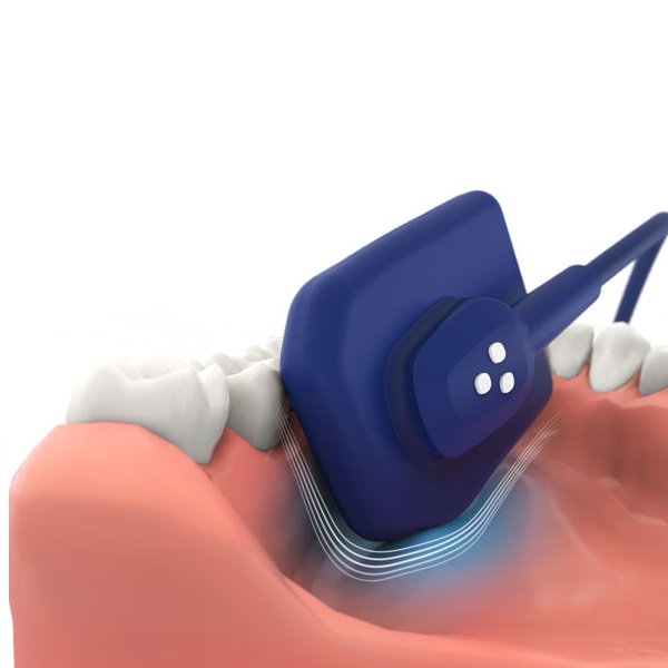 Картинка Аппарат обработки интраоральных изображений EzSensor Soft 1 из 2 